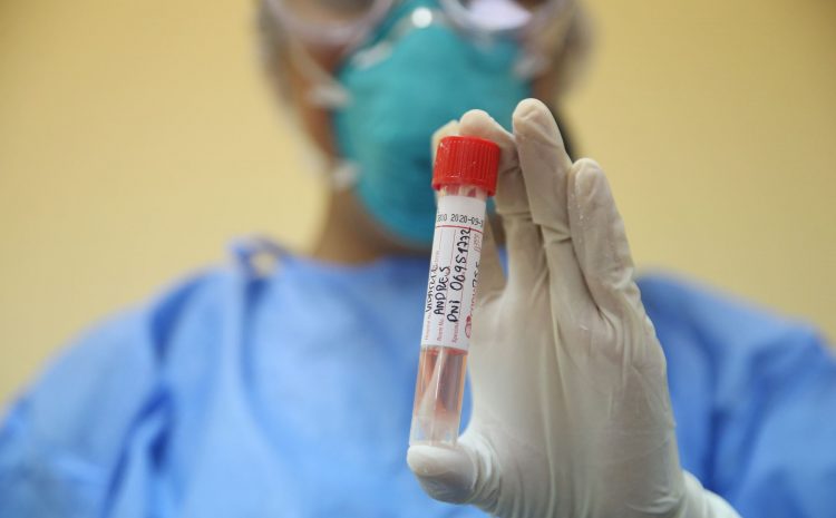  ¿Qué es la prueba Elisa y por qué es una de las mejores metodologías para descartar anticuerpos del Covid-19?